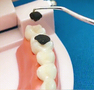 🏆Innealtóireacht bheachtais Ghearmánach! Barr thar a bheith mín 0.1mm le haghaidh flossing beacht✨