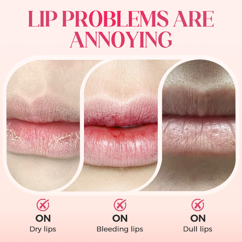 🍓Buy 2 get 1 free🌸Fruity and floral moisturizing lip oil